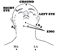 EMG Electrode Placement