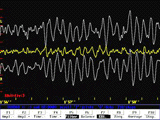 EEG Wave Pattern